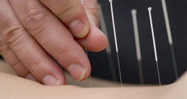 How Acupuncture Aids Allergies