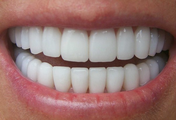 Top Tips To Follow When Seeking Cosmetic Dentistry